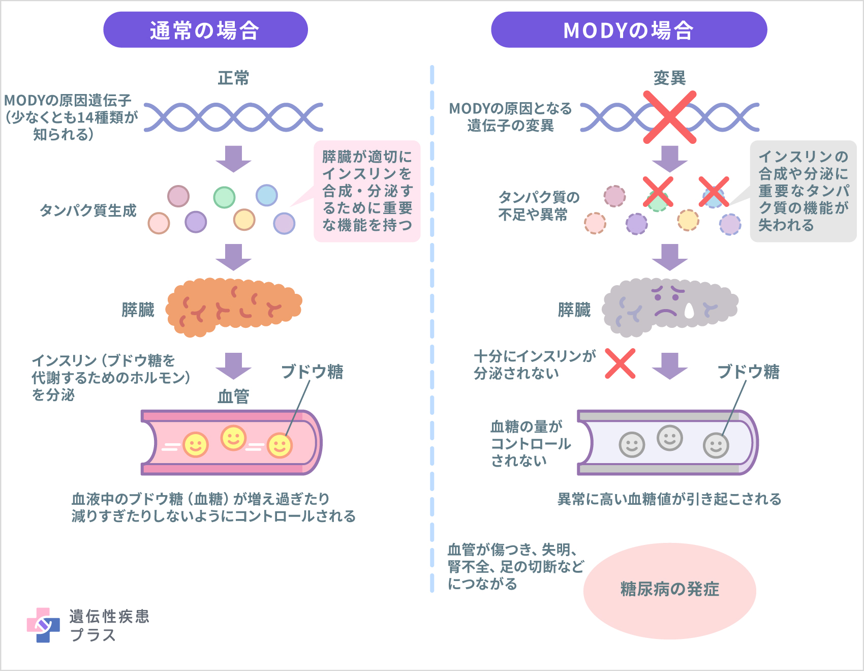 121 Mody（家族性若年糖尿病） 仕組み 241114