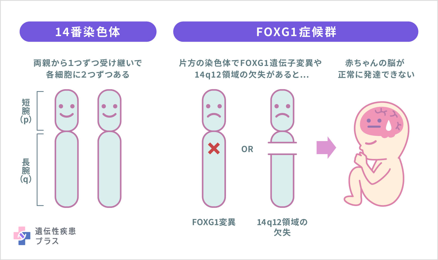 62 Foxg1症候群 病気の仕組み