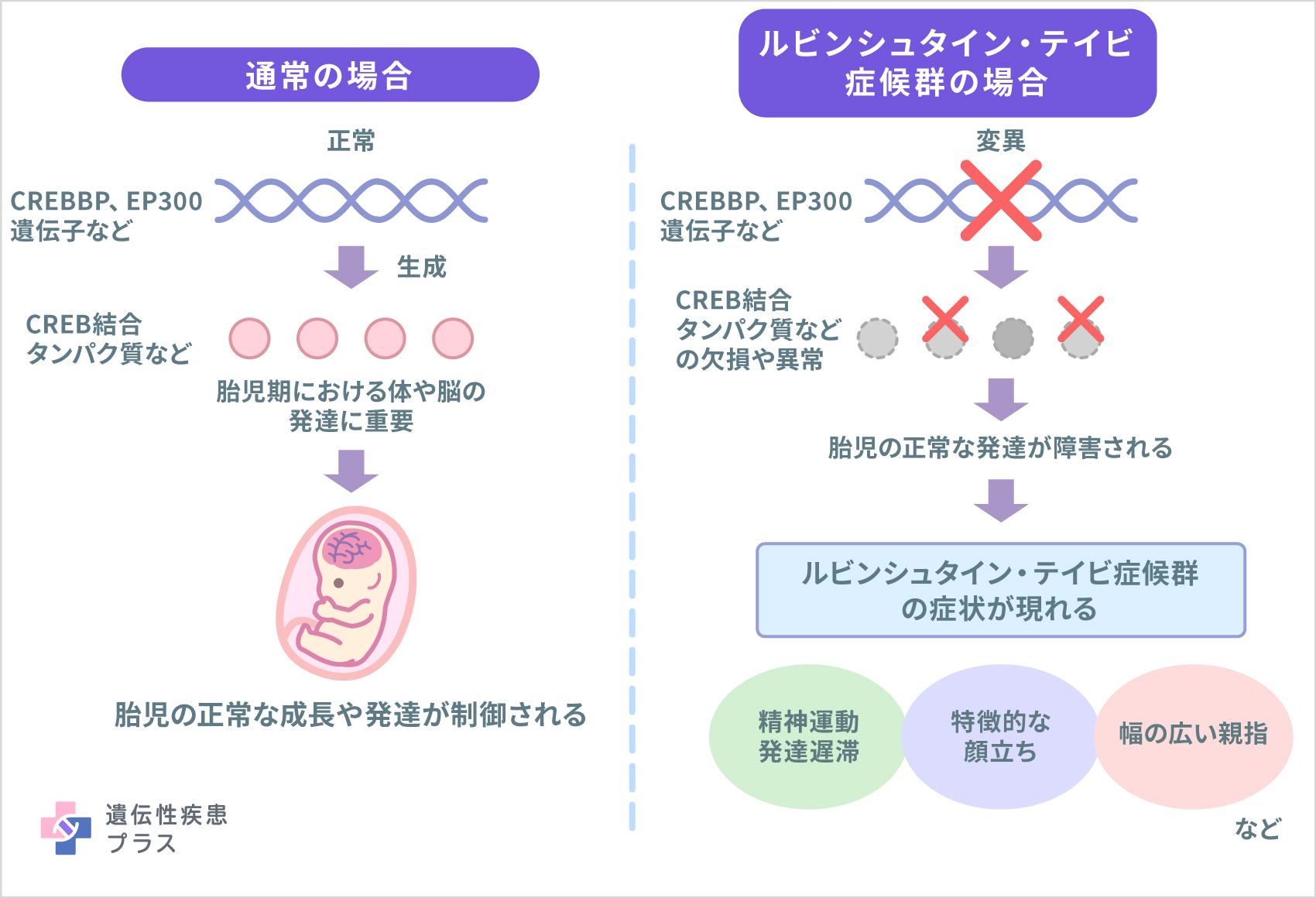 154 ルビンシュタイン・テイビ症候群 仕組み