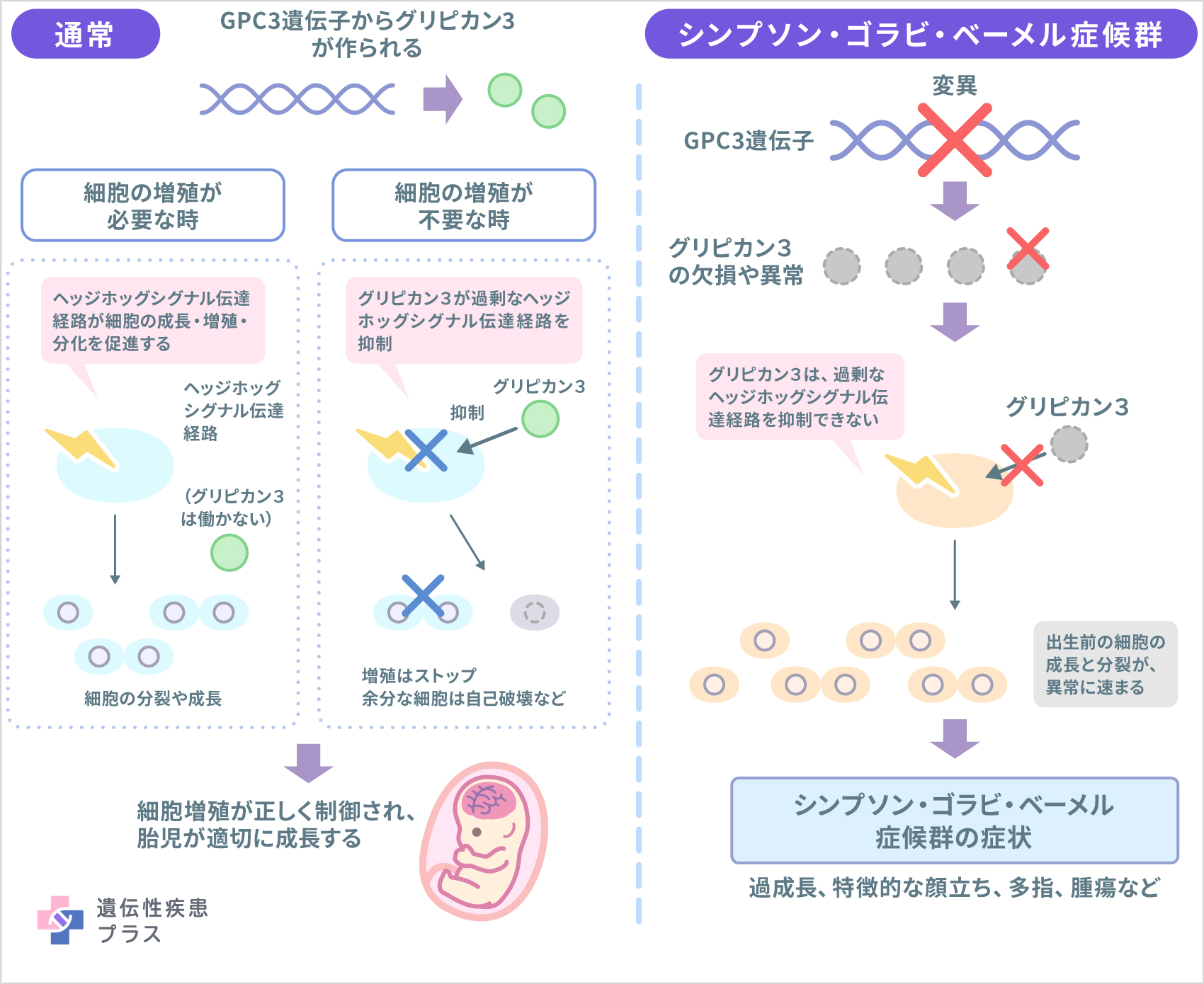 160 シンプソン・ゴラビ・ベーメル症候群 仕組み 241118