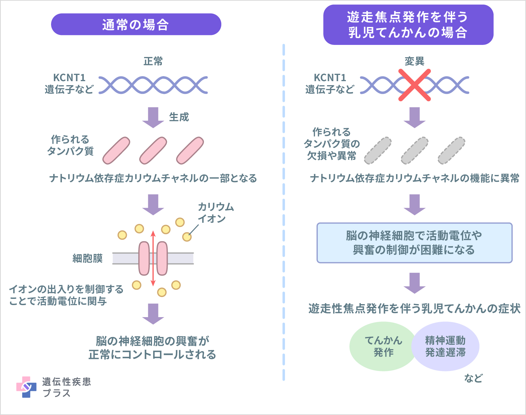 159 遊走性焦点発作を伴う乳児てんかん 仕組み 241118