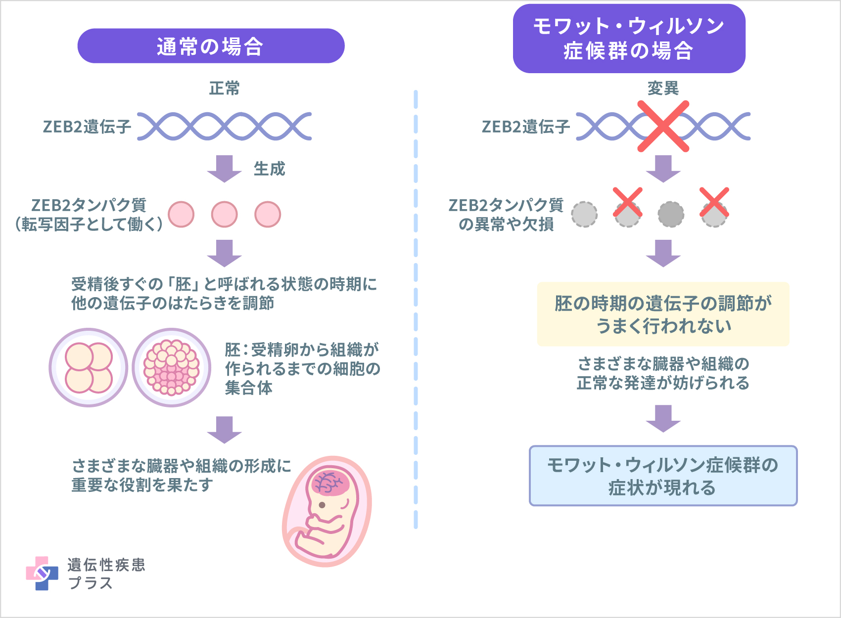 166 モワット・ウィルソン症候群 仕組み 241212