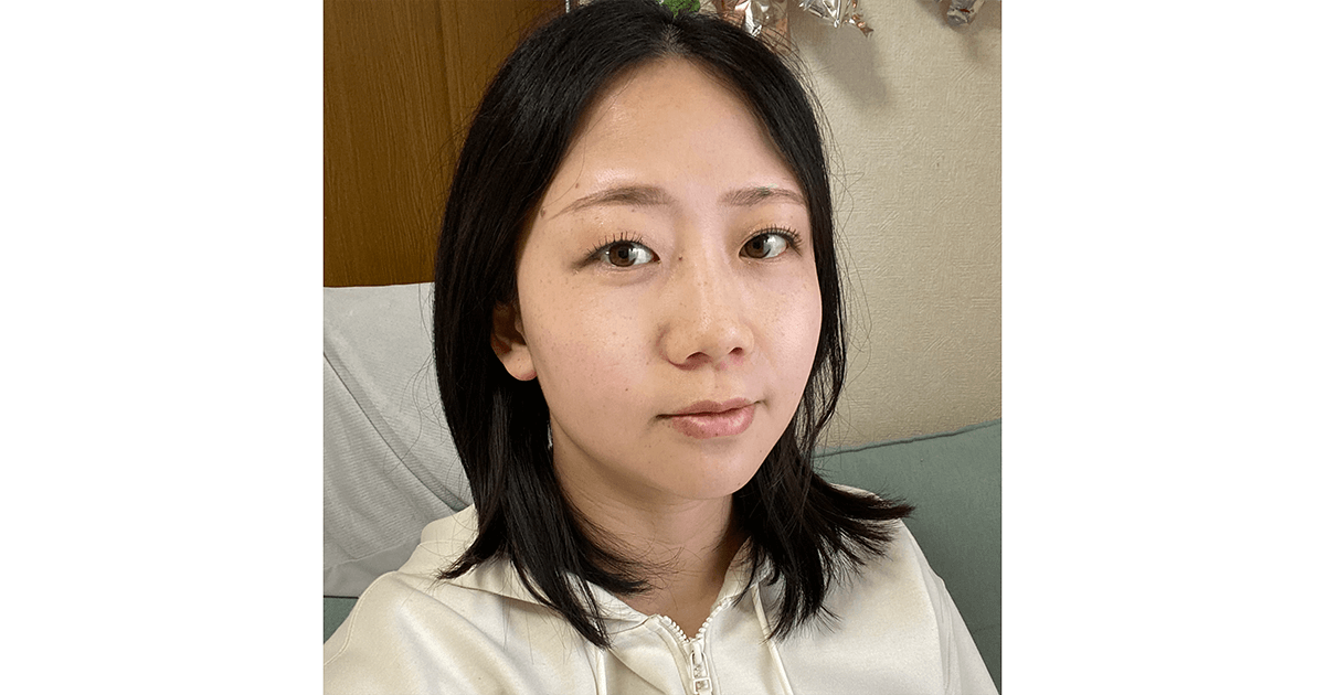 Kleefstra Syndrome 01